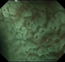 Endoscopy image example