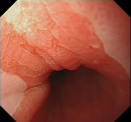 Endoscopy image example