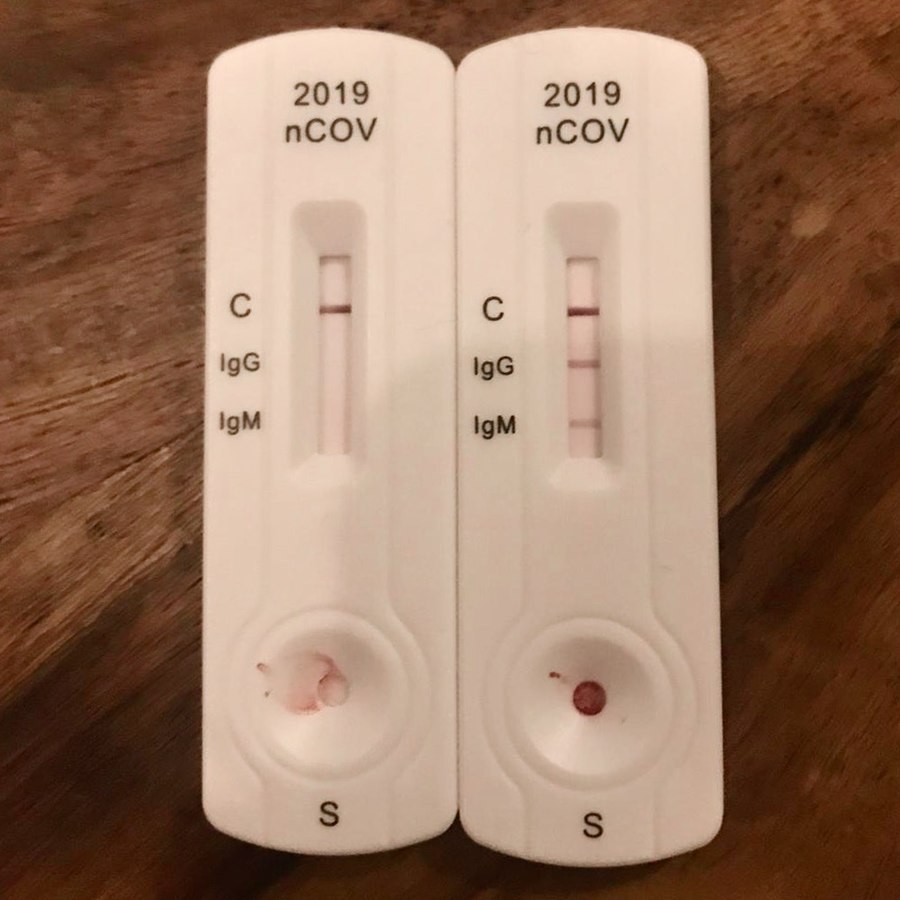 Lateral Flow Devices Detect Most Infectious COVID 19 Cases Study Shows   900px IgGIgM Covid19 Test 