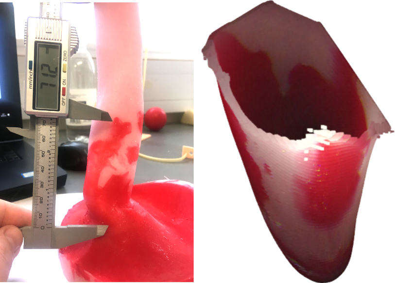 Model of the oesophagus, with the amount of inflammation being measured.