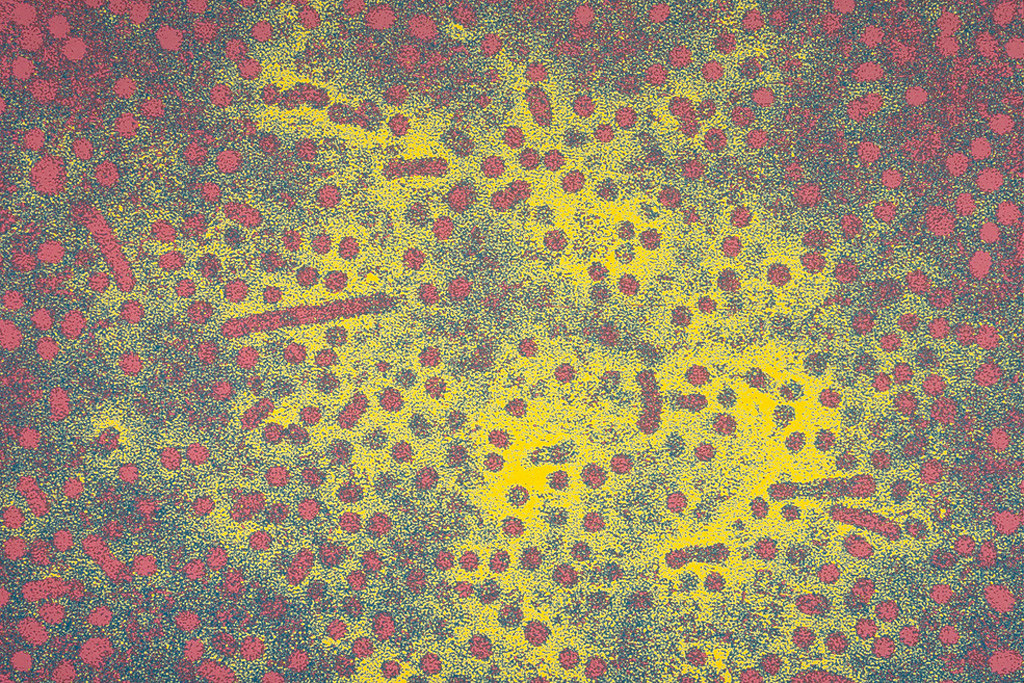 Microscopic image of the hepatitis B virus 