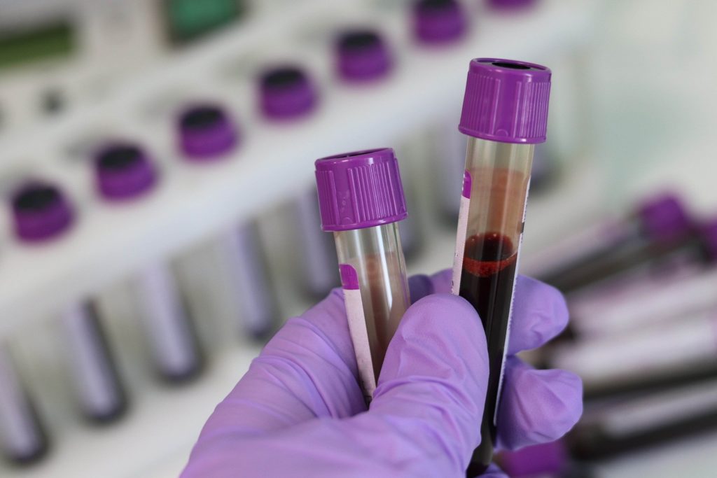 Researcher holding blood samples