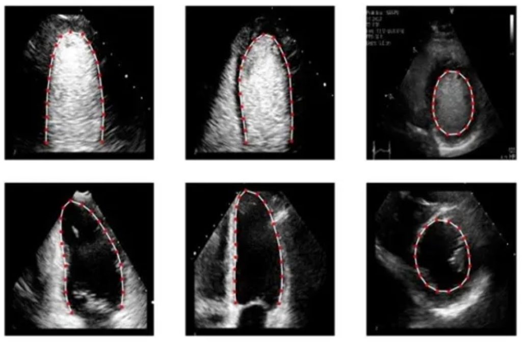 echocardiogram images
