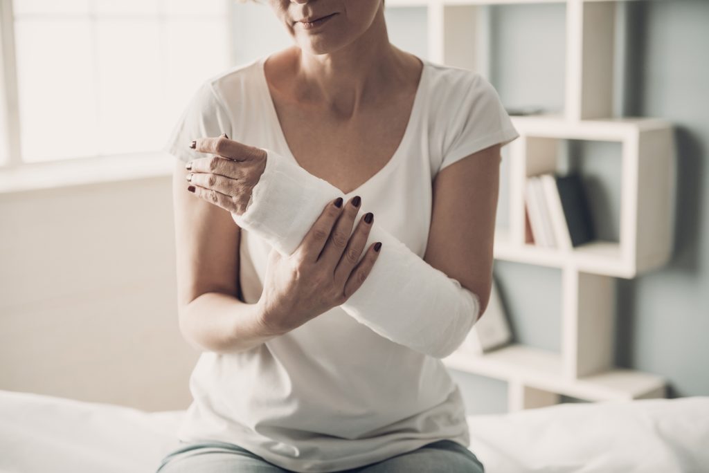 A woman with her arm in a plaster cast