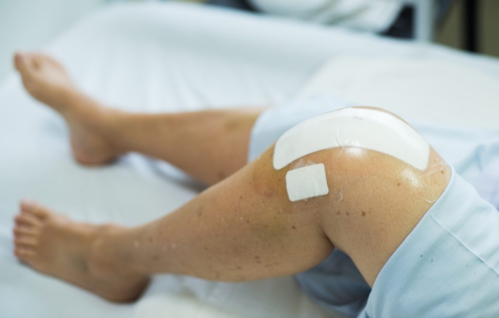 patient recovering after knee operation 