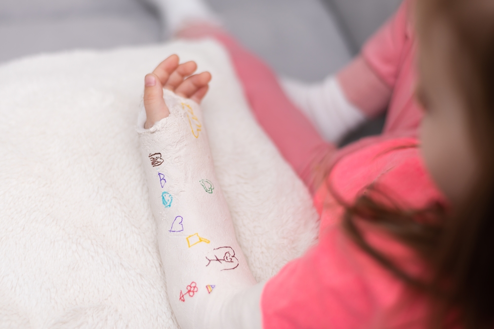 Child with their arm in a plaster cast