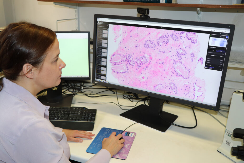 Professor Clare Verrill uses the new AI pathology software
