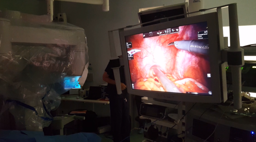 Screen in theatre showing prostate cancer surgery 