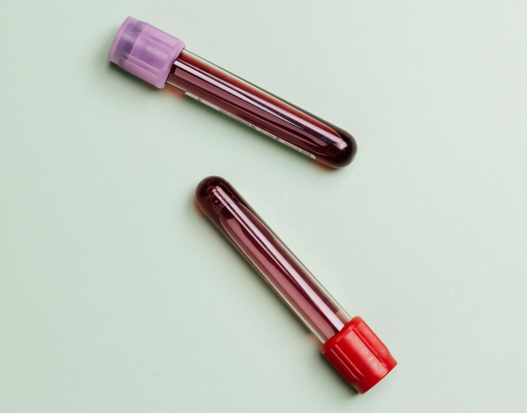 two vials of blood