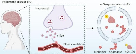three-part diagram showing human brain, alpha synuclein inside a neuron cell, and alpha synuclein proteins aggregating in an extracellular vesicle.