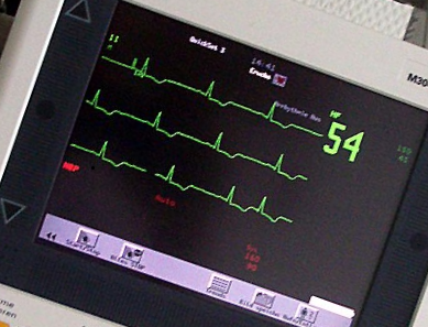 heart monitor